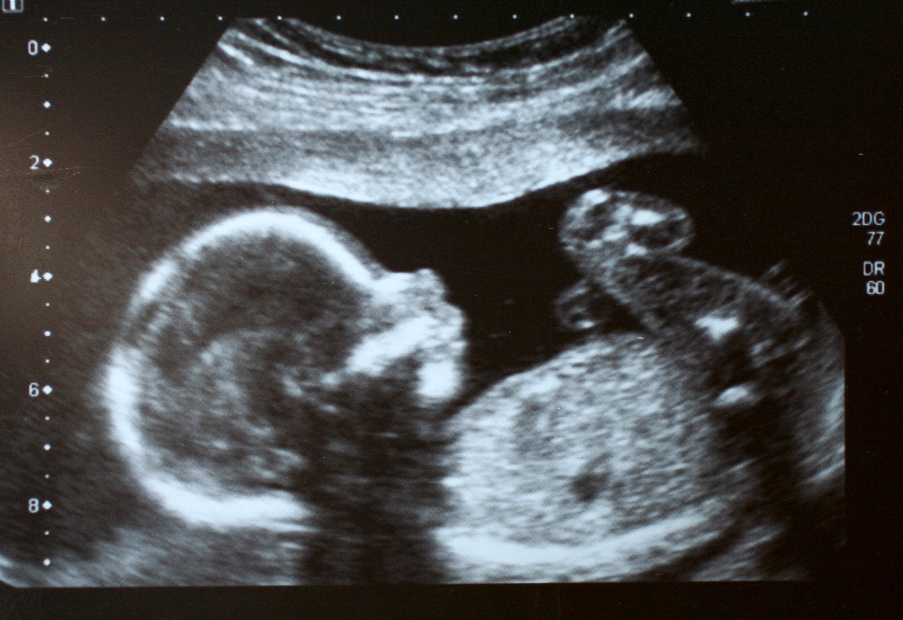 Social media has made the ‘reveal’ of scan photos something of a ritual for pregnant women