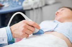 Unregulated ultrasounds like these are putting pregnant women like me at risk
