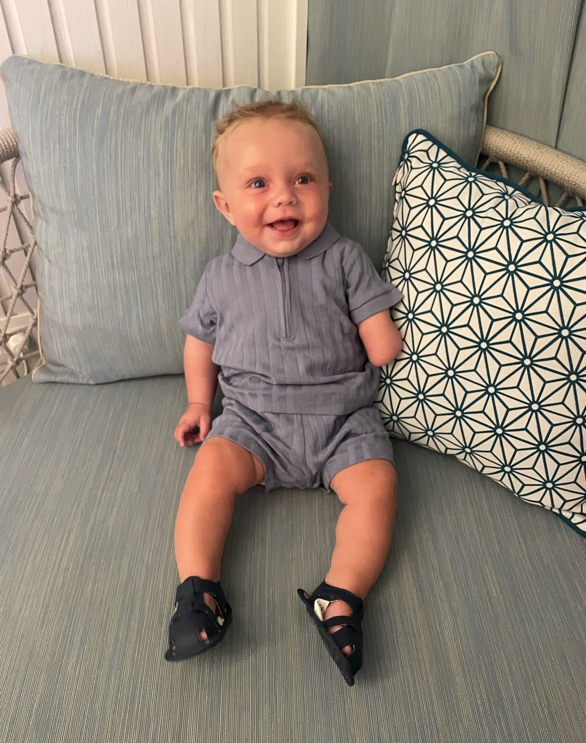 Baby boy&rsquo;s hand severed in utero due to extremely rare condition