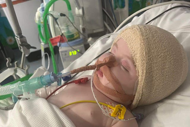 Emilie Sime recovering from surgery to remove a brain tumour at the Royal Hospital for Children in Glasgow after diagnosis aged three months old (NHS GGC/PA Wire).