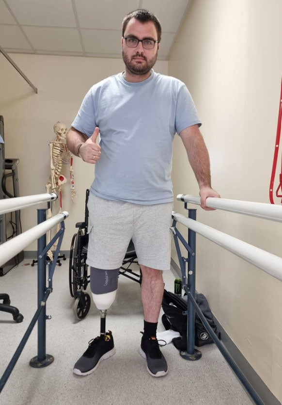 Aaron Haley had his leg amputated