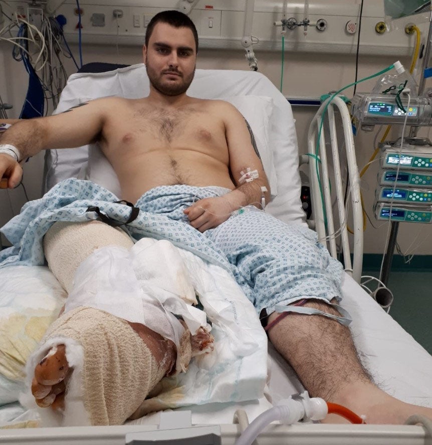 Aaron Haley pictured after his accident