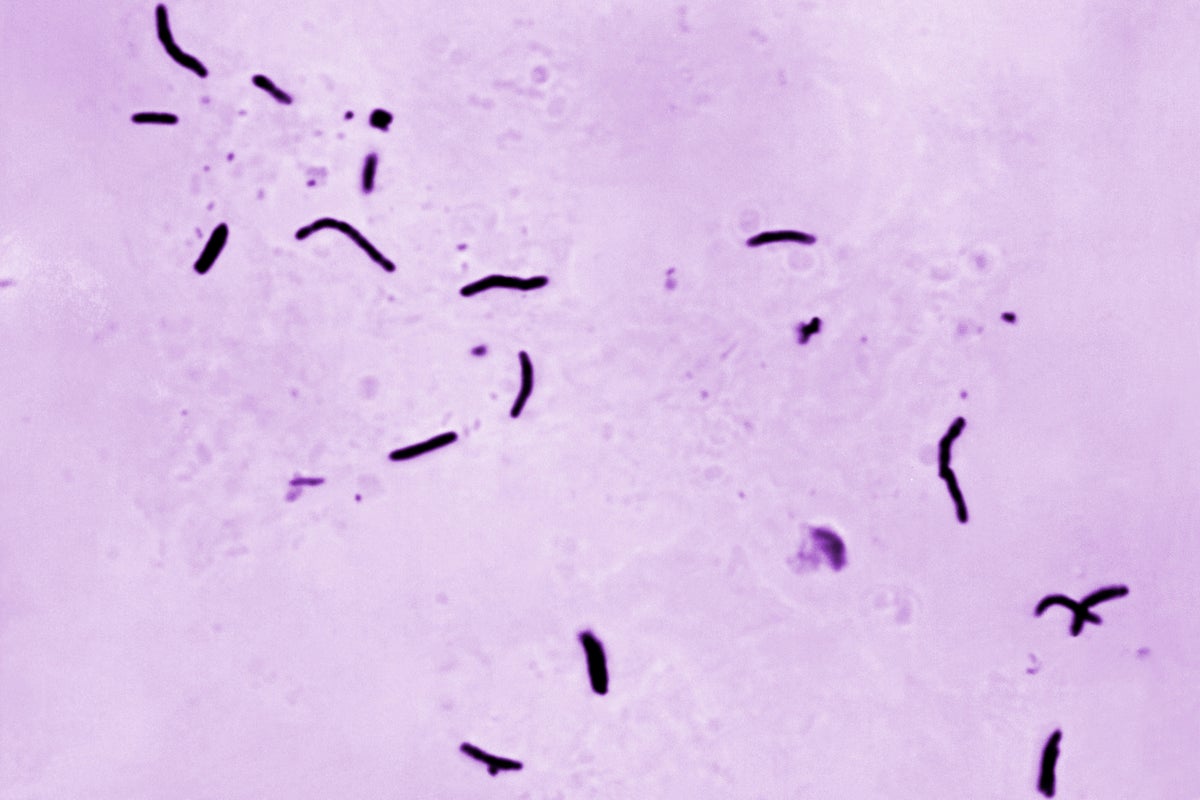The bacterial infection linked to hundreds of deaths across England