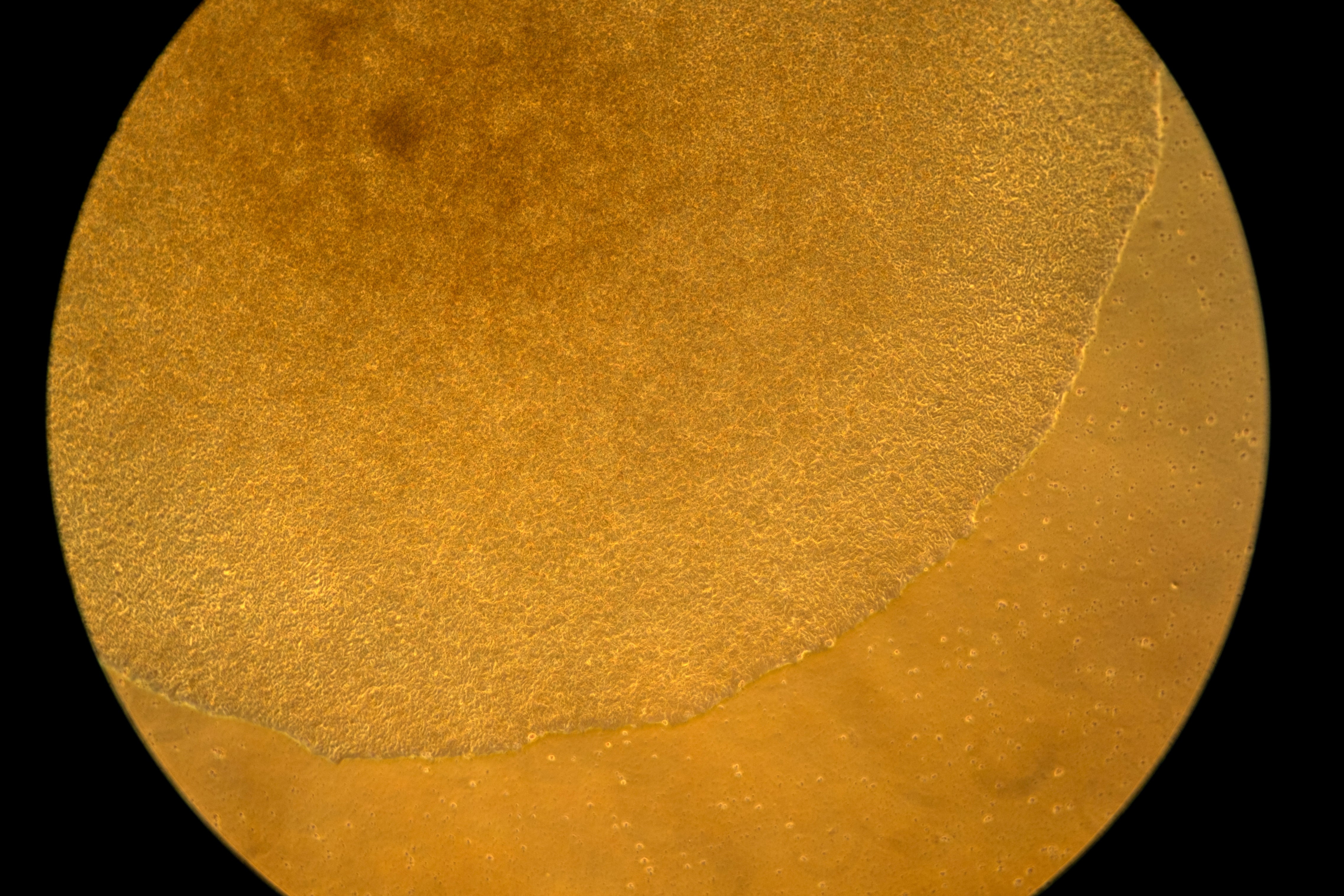 Autoimmunity New Treatments