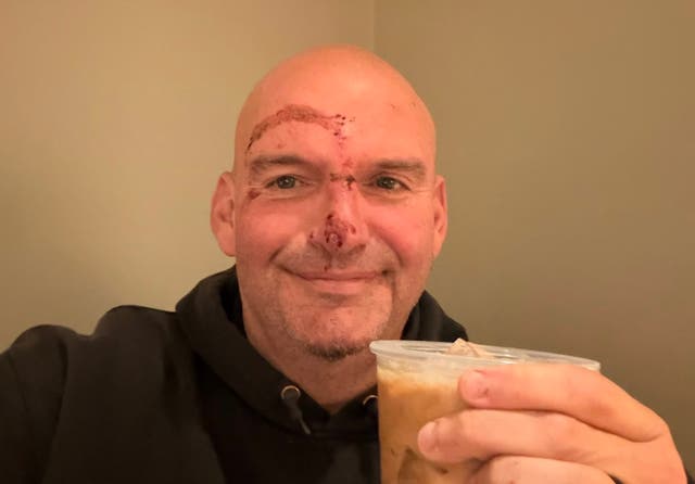 <p>Pennsylvania Sen. John Fetterman revealed that he received 20 stitches following a fall near his home two days ago, prompted by a flare-up of a cardiac-related issue</p>