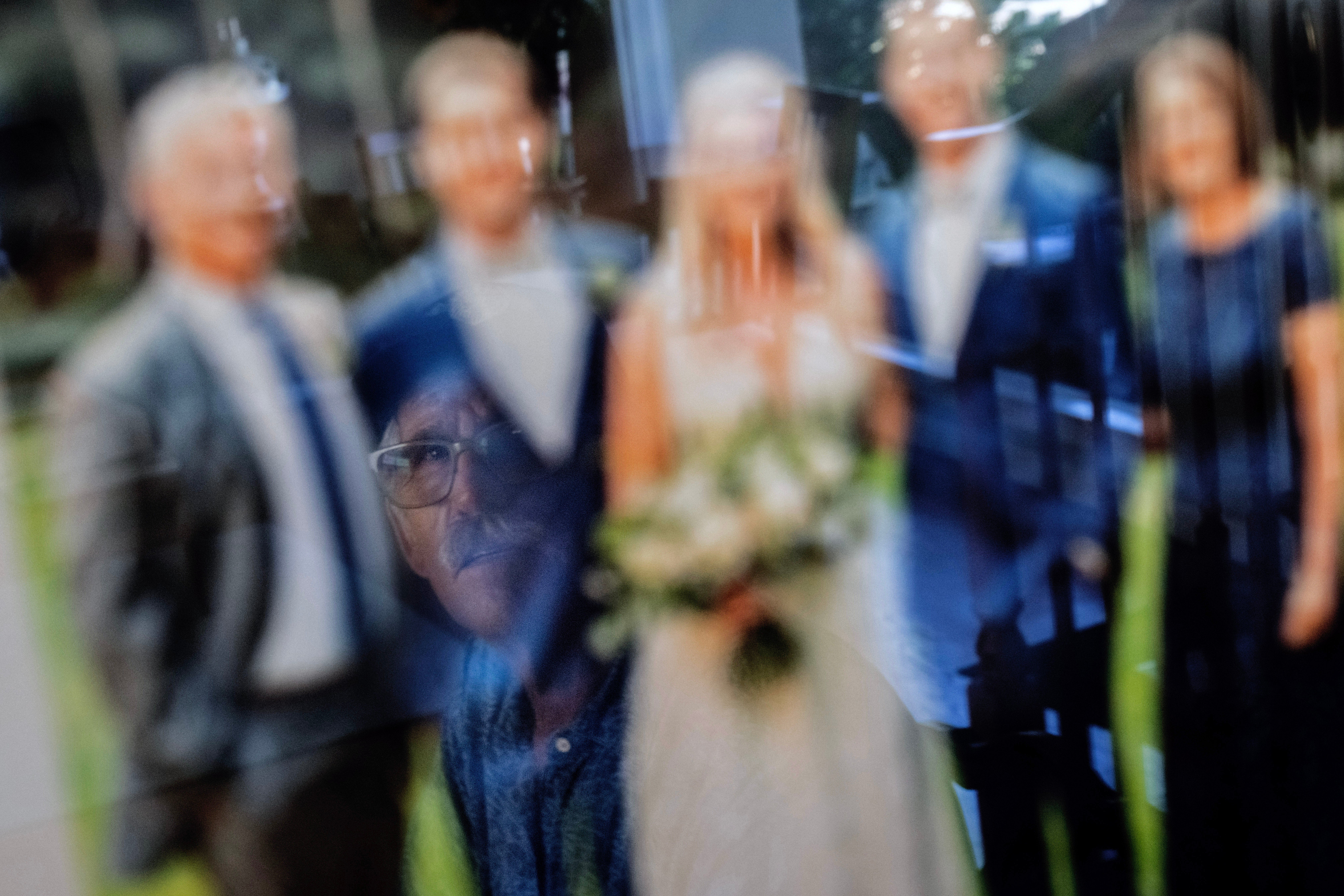 Autoimmune Diseases Brain Photo Essay