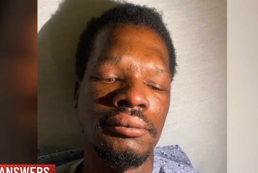 Louis Smith, who has limited mobility, was stung over 400 times by bees