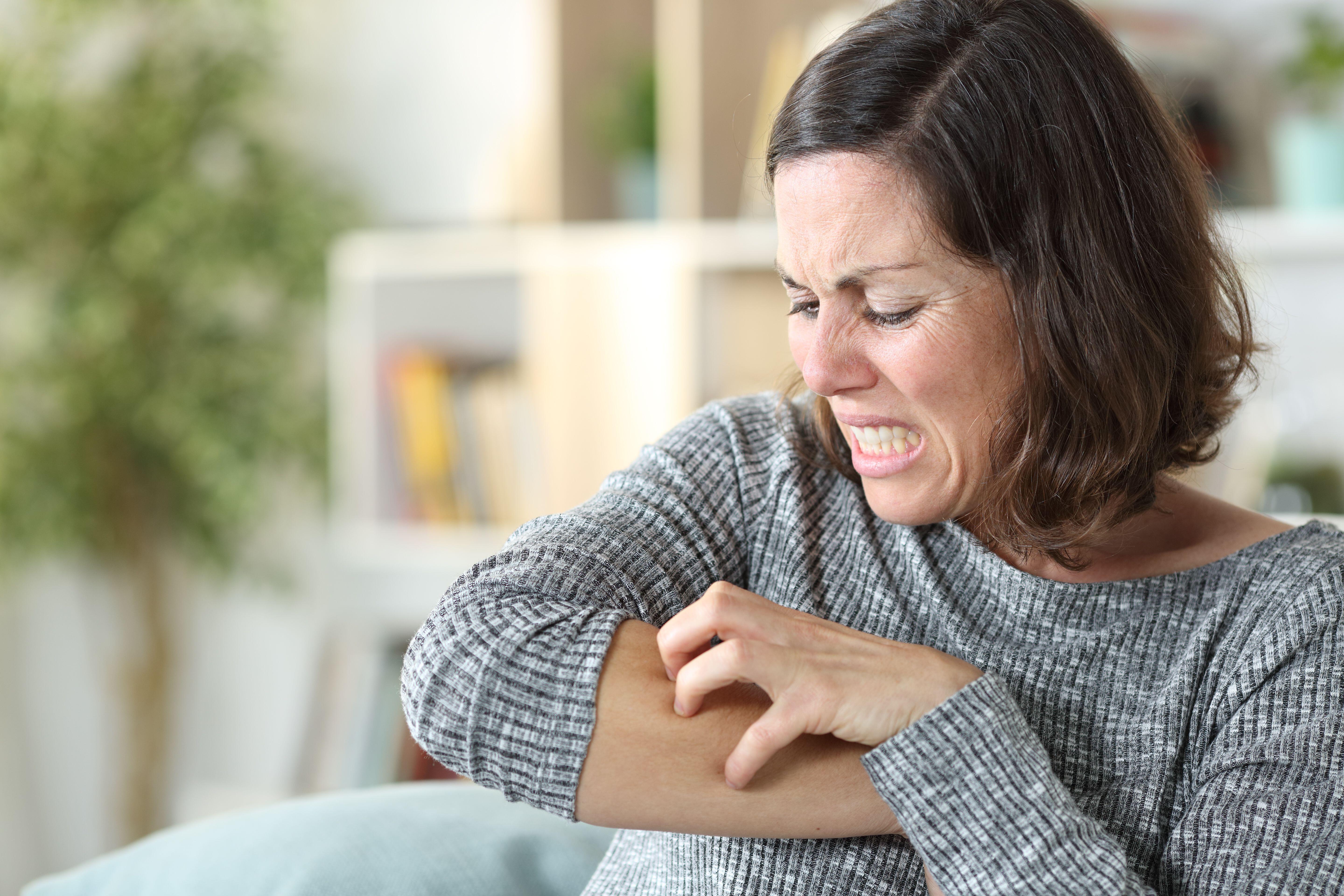 Cold temperatures can trigger eczema or Raynaud’s flare-ups.