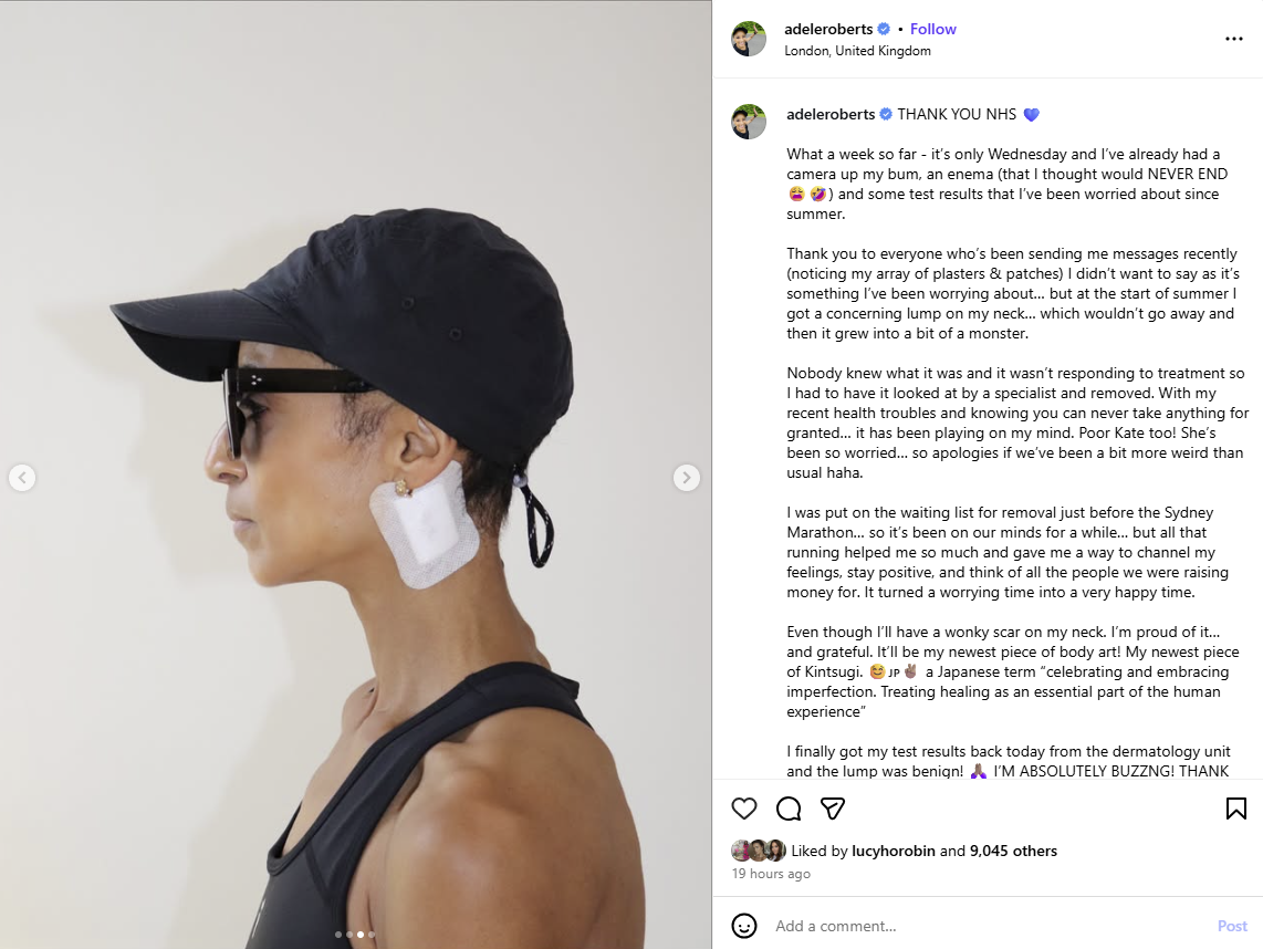 উপস্থাপক এবং রিয়েলিটি টিভি তারকা অ্যাডেল রবার্টস বলেছেন যে তার ঘাড় থেকে সরানো একটি 