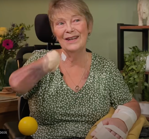 Kim Smith had a hand transplant after losing her limbs to sepsis