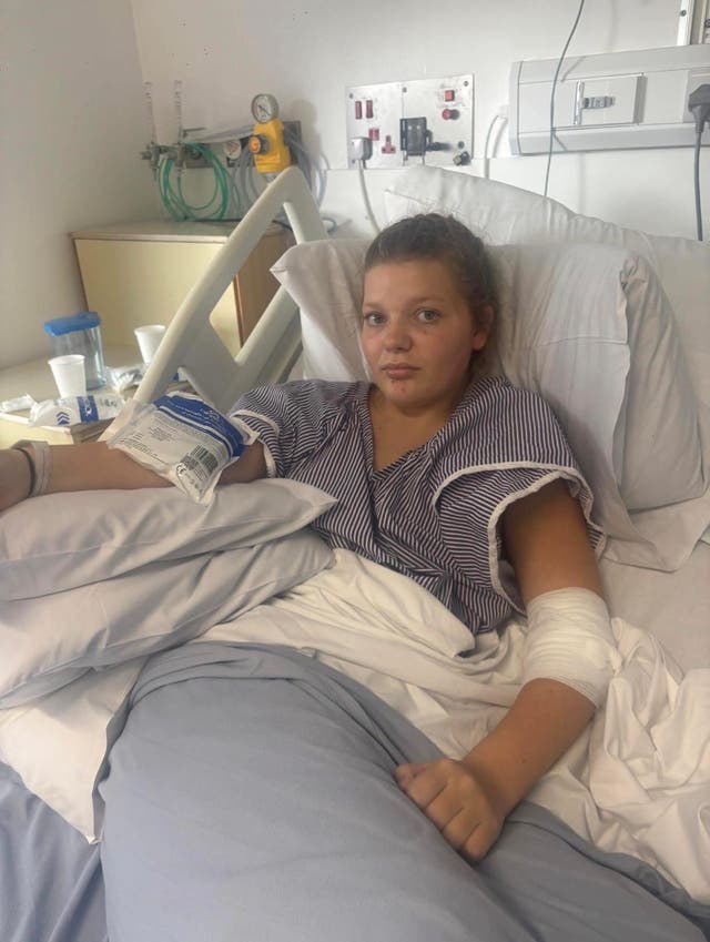 <p>Millie Fairley, 13, from Eastbourne, who has been diagnosed with an extremely rare blood disorder called aplastic anaemia</p>