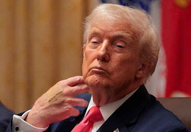 <p>President Donald Trump’s right hand, which is frequently bruised, appeared to have two Band-Aids covering up a section that also appeared to have makeup </p>