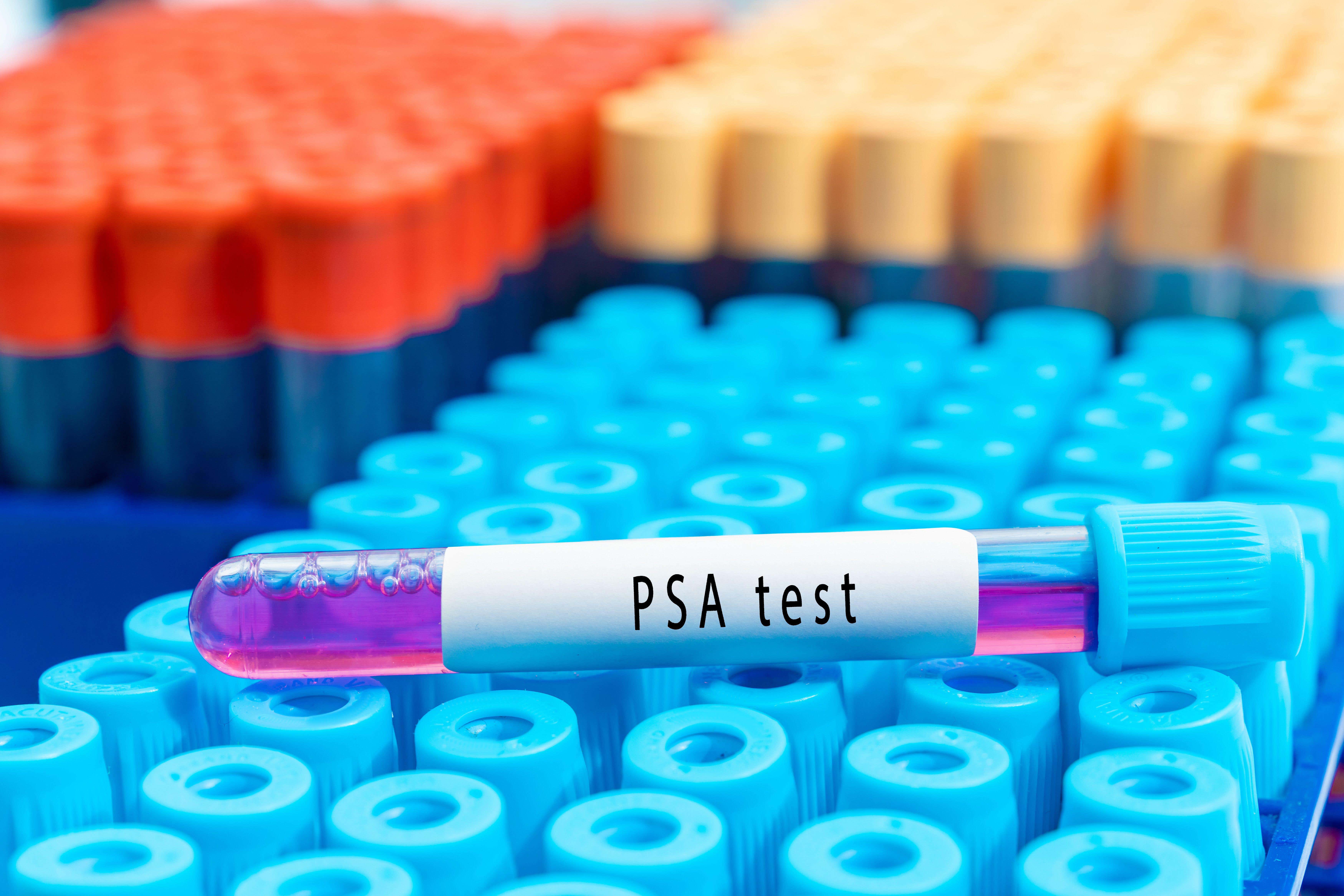 independent.co.uk - Jane Kirby - Trial for prostate cancer treatment with fewer side-effects launches in UK