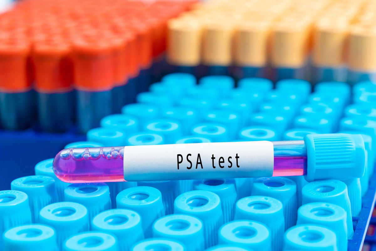 Ads for ‘misleading’ prostate supplements and home testing kits banned