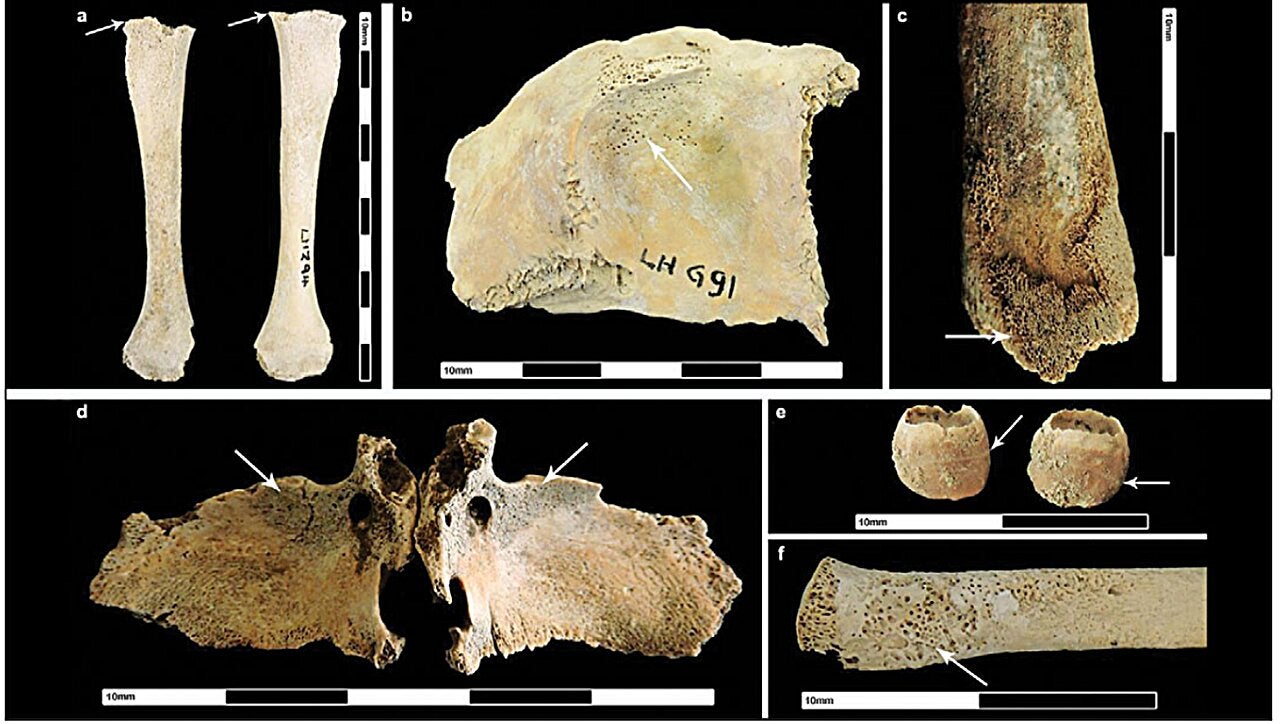 Signs of diseases among Roman-era British children