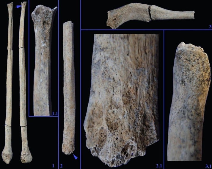 The teenager was left with a number of injuries