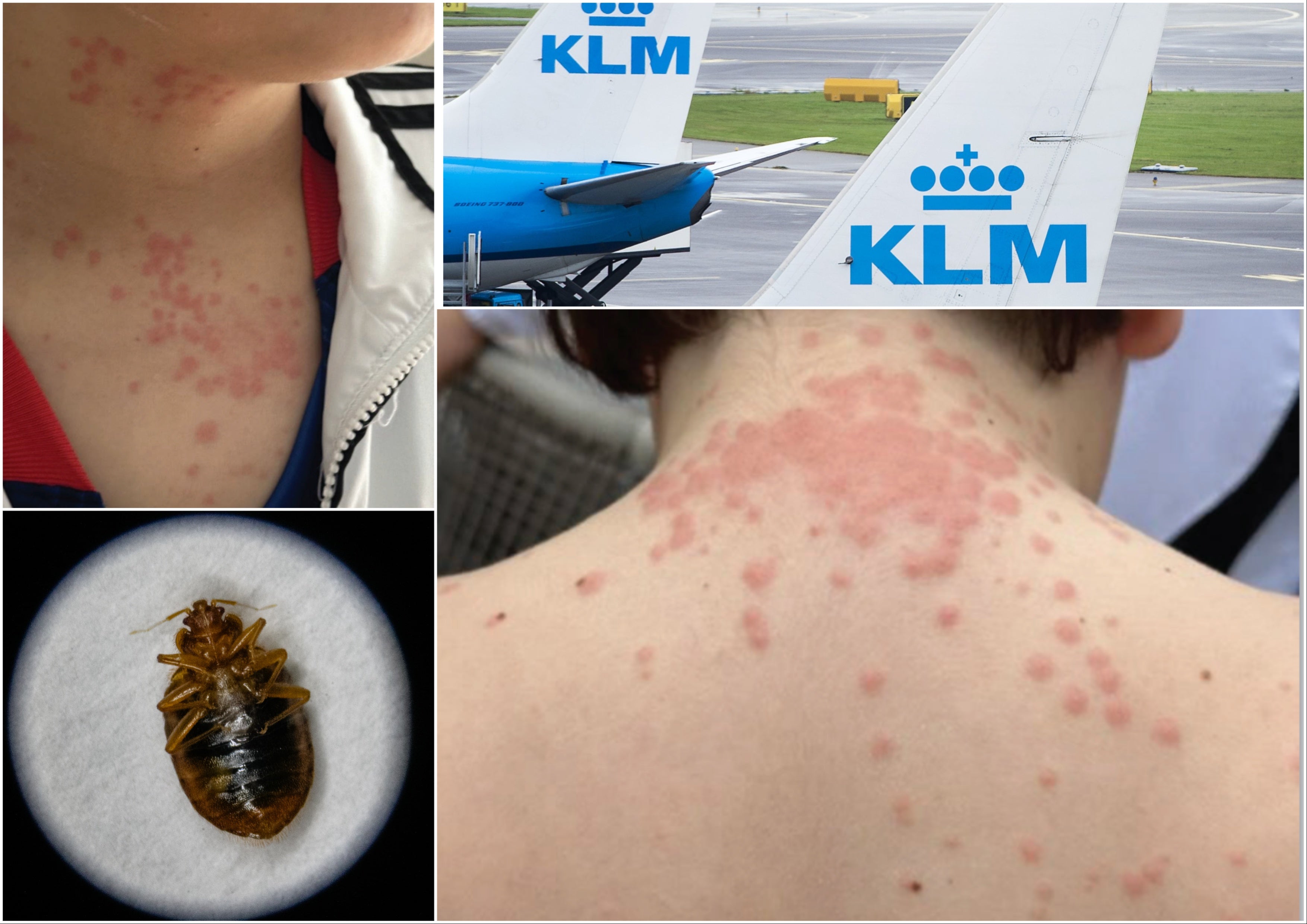 <p>A Virginia family says their vacation was over before it even began, thanks to an alleged bed bug infestation aboard their plane</p>