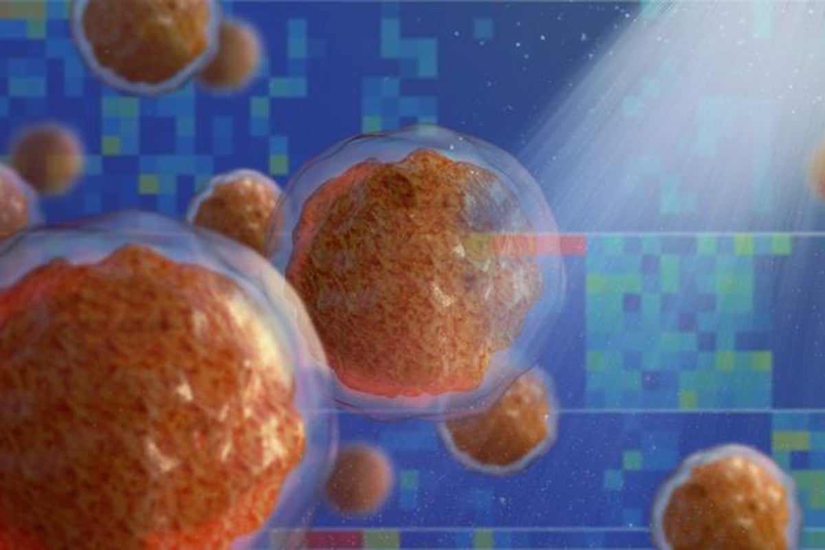 Scientists say this silent bone change could be early sign of leukaemia Scientists say this silent bone change could be early sign of leukaemia