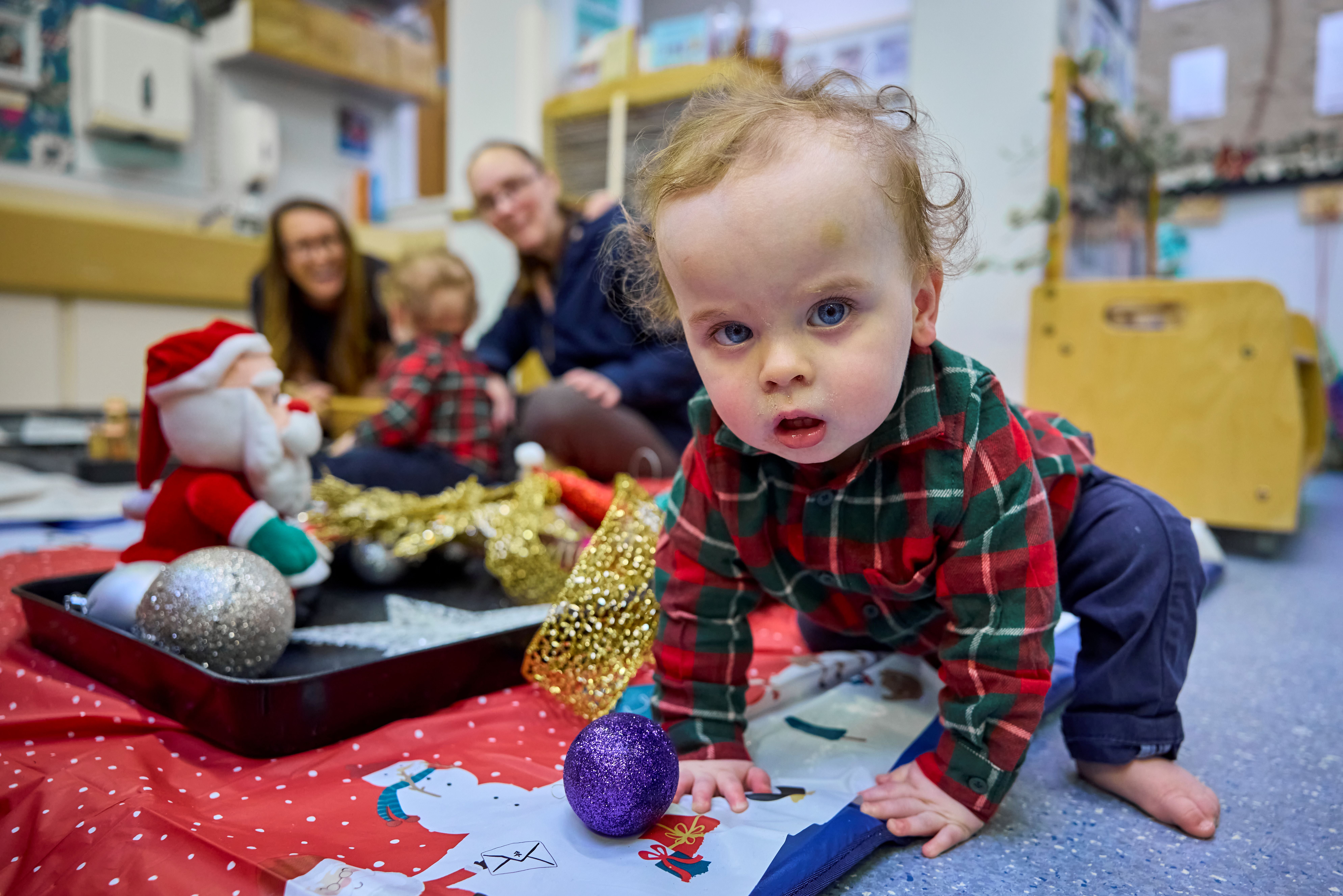 There is no cure for ocular albinism, but it can be managed, and it will not worsen