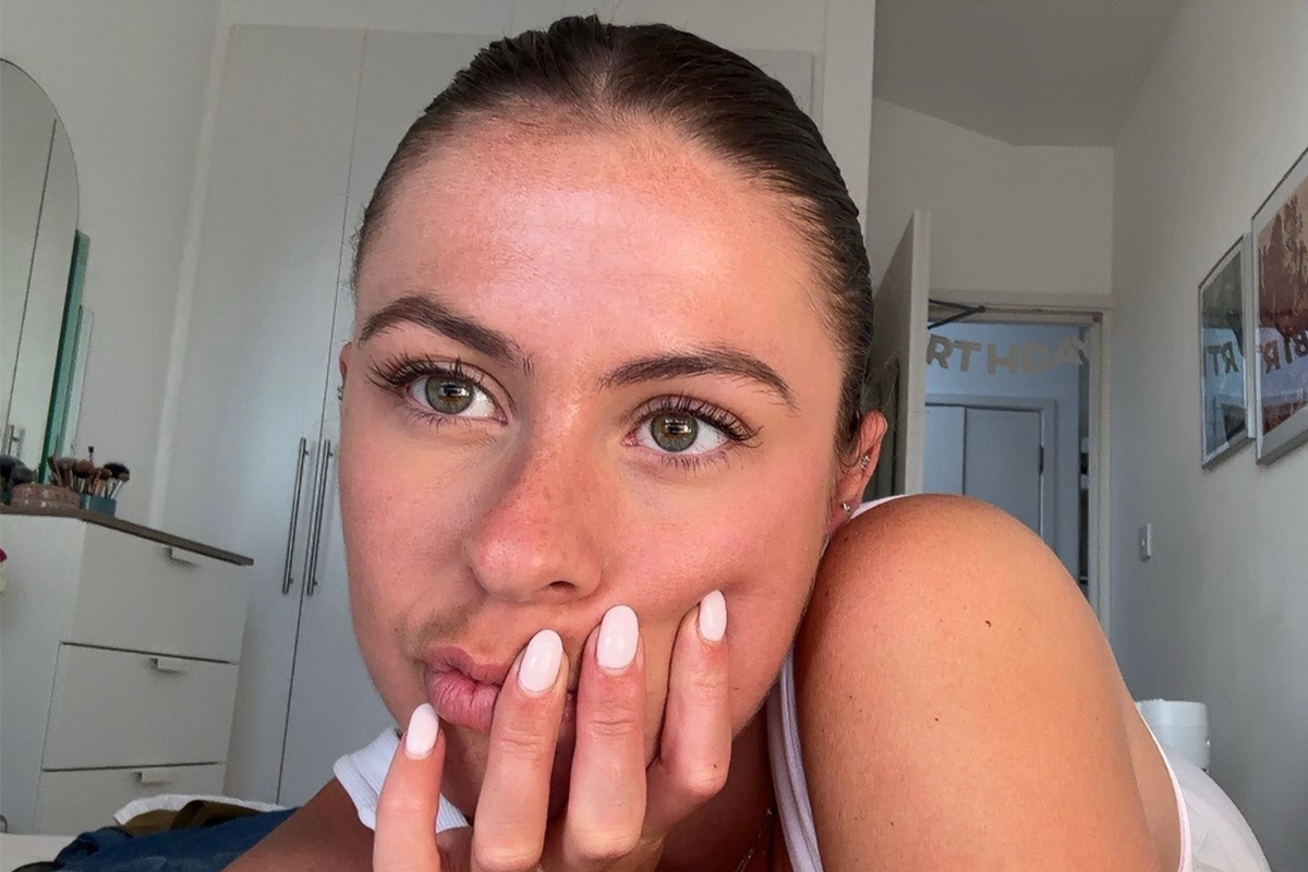 How high-risk Botox habits have become normalised for twentysomethings like me How high-risk Botox habits have become normalised for twentysomethings like me