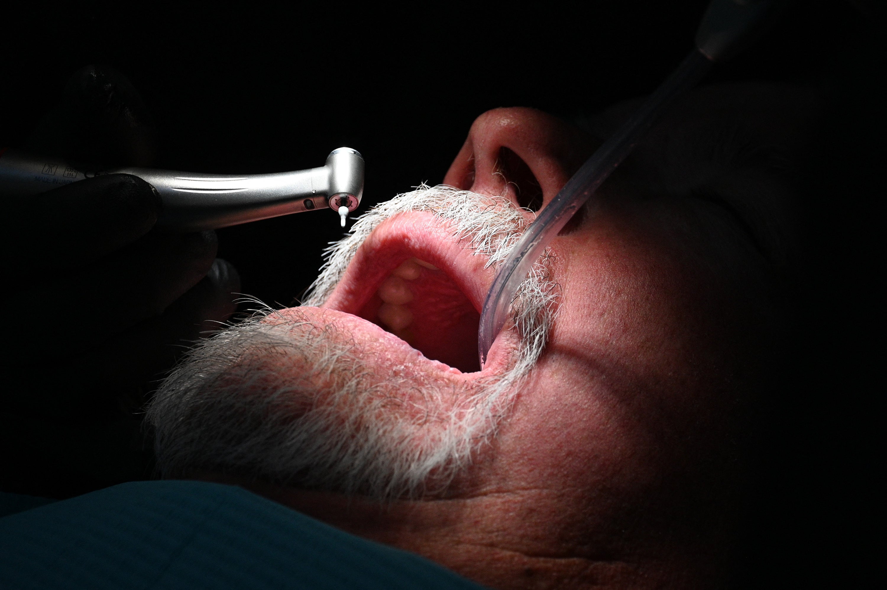 <p>A dentist at work at the Rubio Dental Group in Los Algodones, Mexico</p>