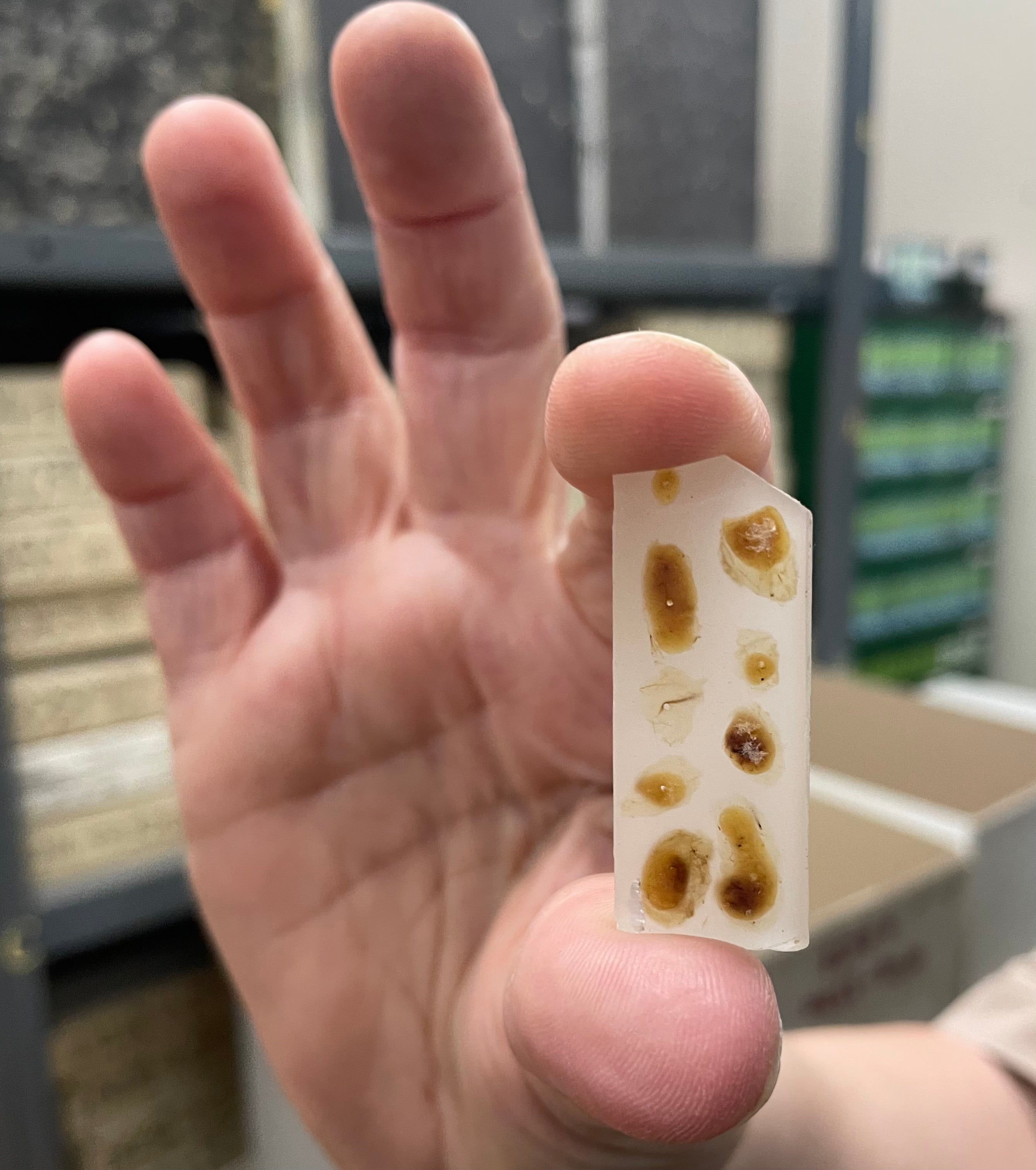 Biopsy set in wax stored in the basement of St Marks Hospital in London