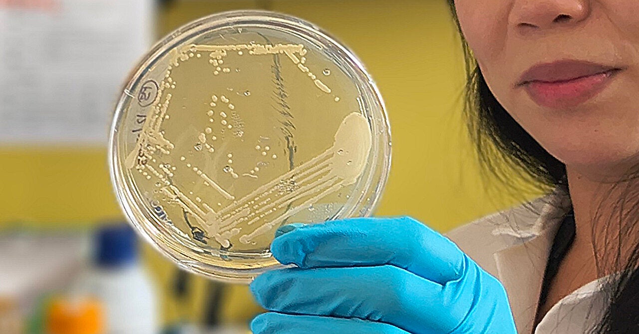 Study first author Cynthia Hsu examines stool culture from a patient
