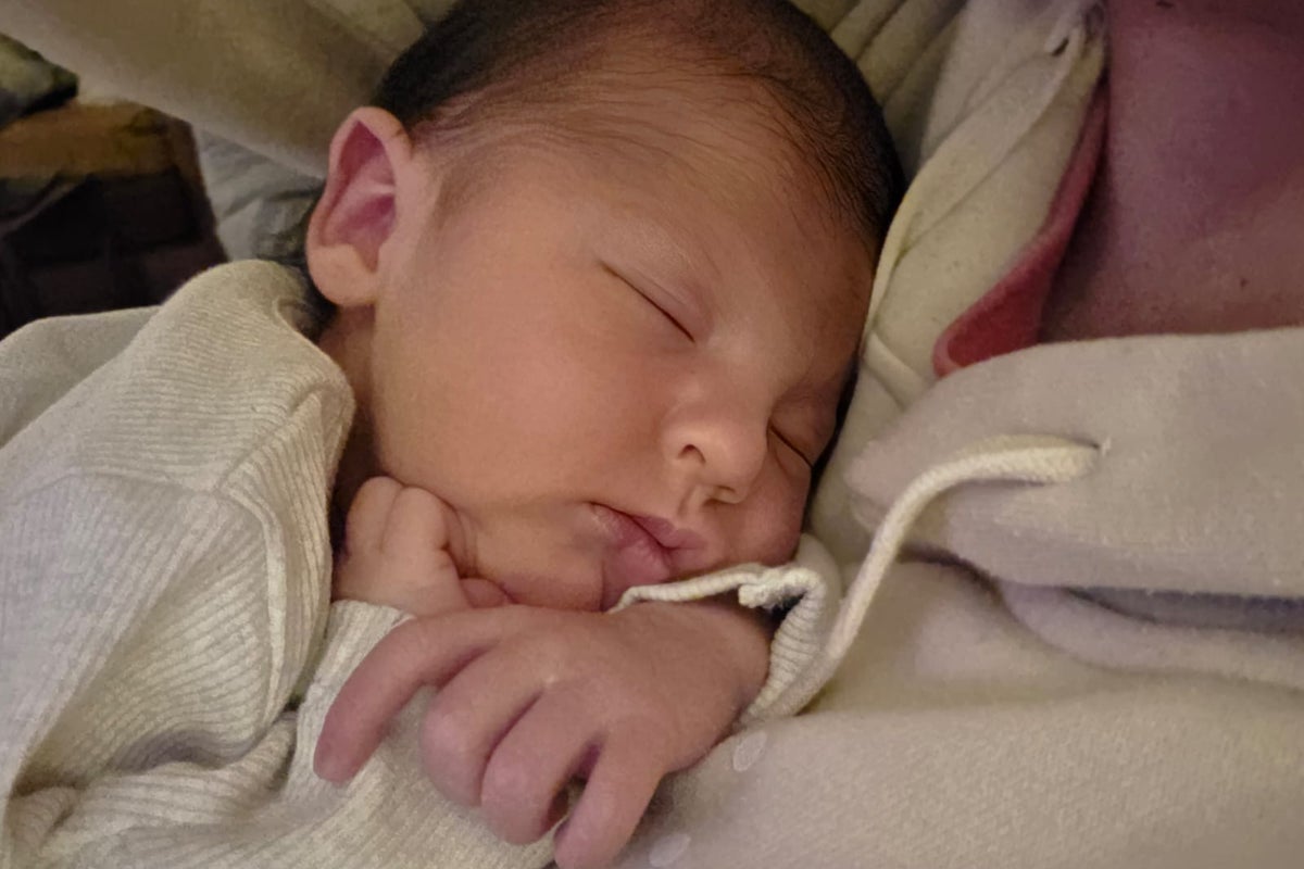 Newborn babies with jaundice can now receive vital treatment from home Newborn babies with jaundice can now receive vital treatment from home