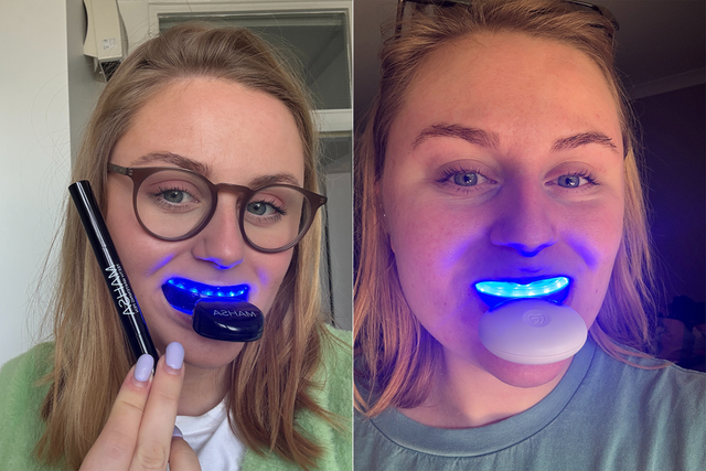 <p>I tested a variety of teeth whitening treatments over the course of many months</p>