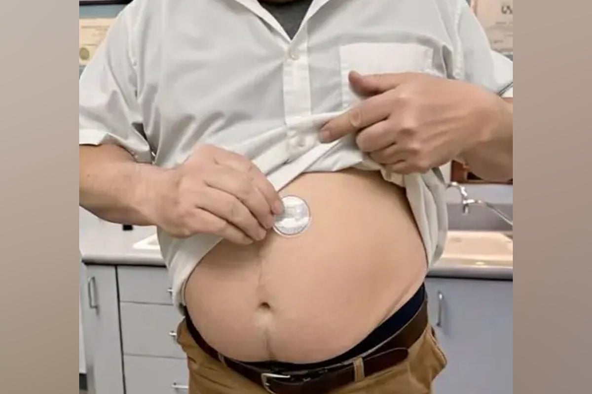 NHS trust issues warning over AI-generated videos