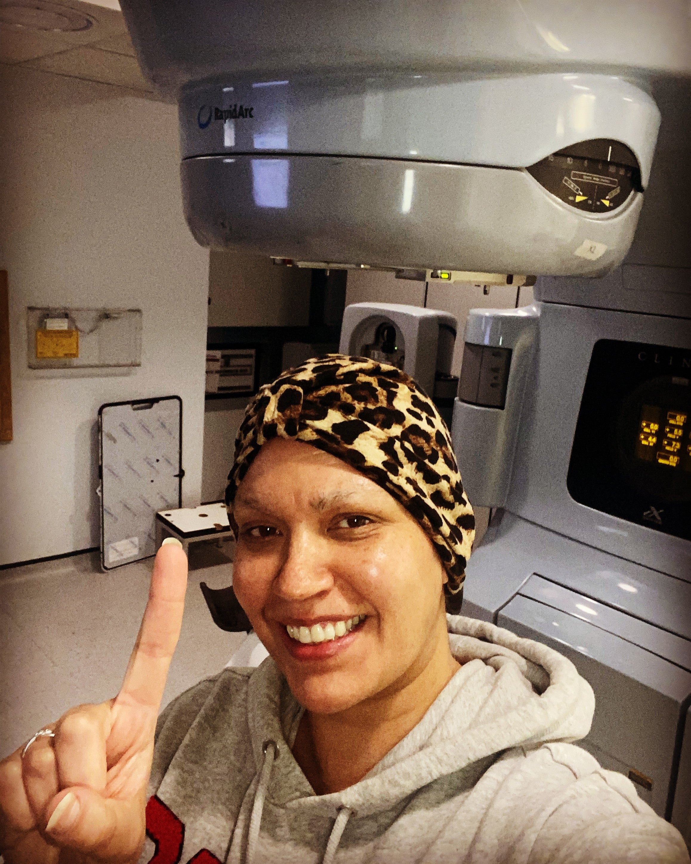 <p>Vicki had a mastectomy on her right breast</p>