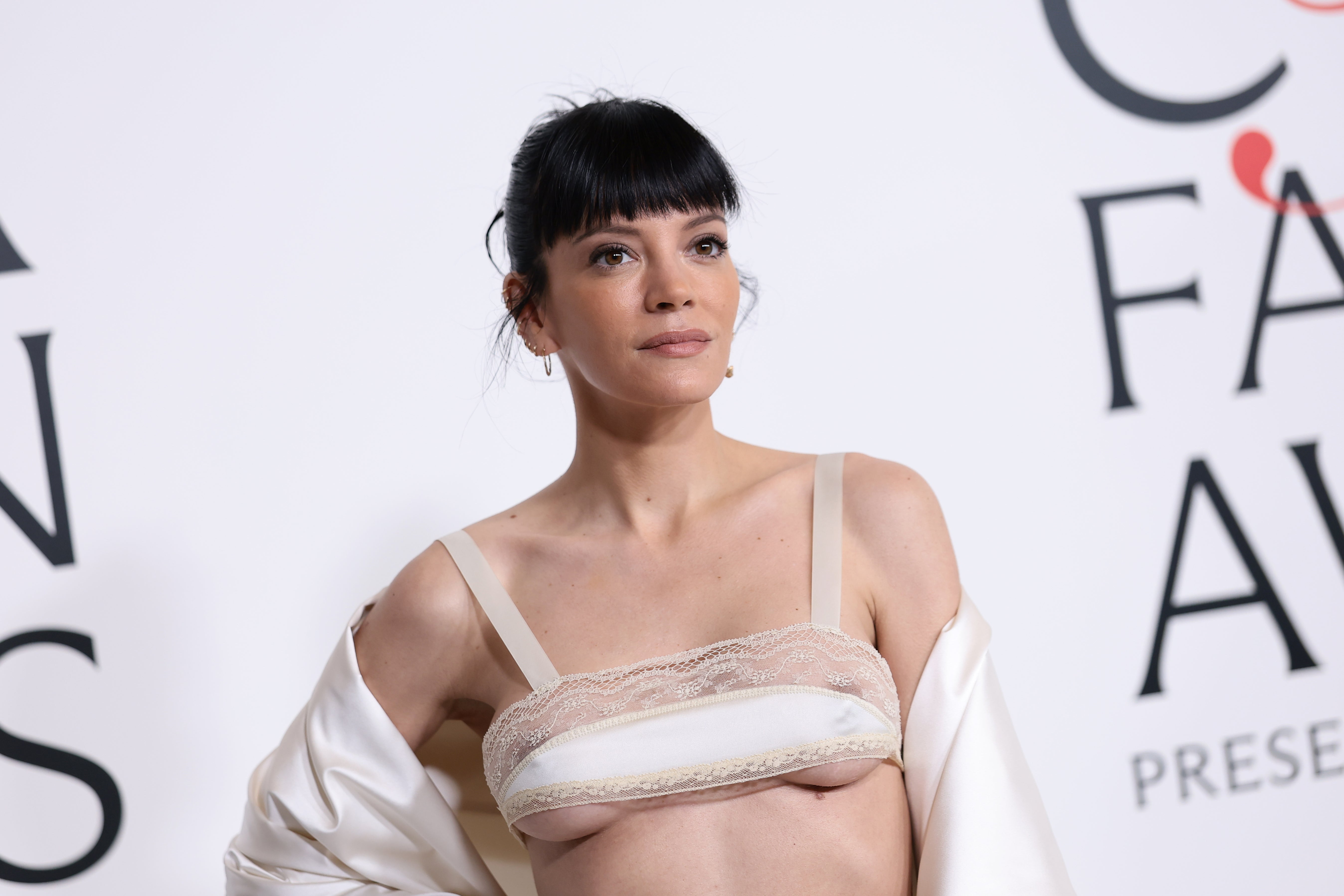 <p>Lily Allen has revealed that she was recently in a car accident that ran her off the road</p>