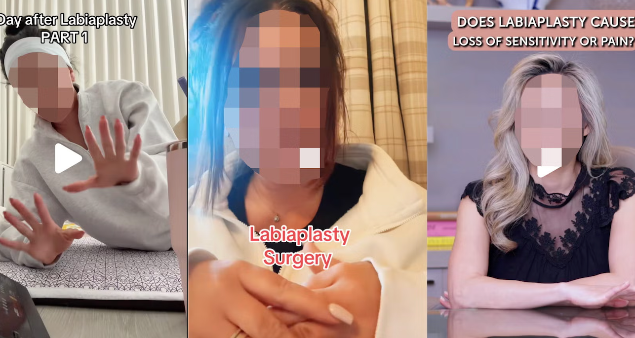 Labiaplasty has surged as a TikTok trend in recent months