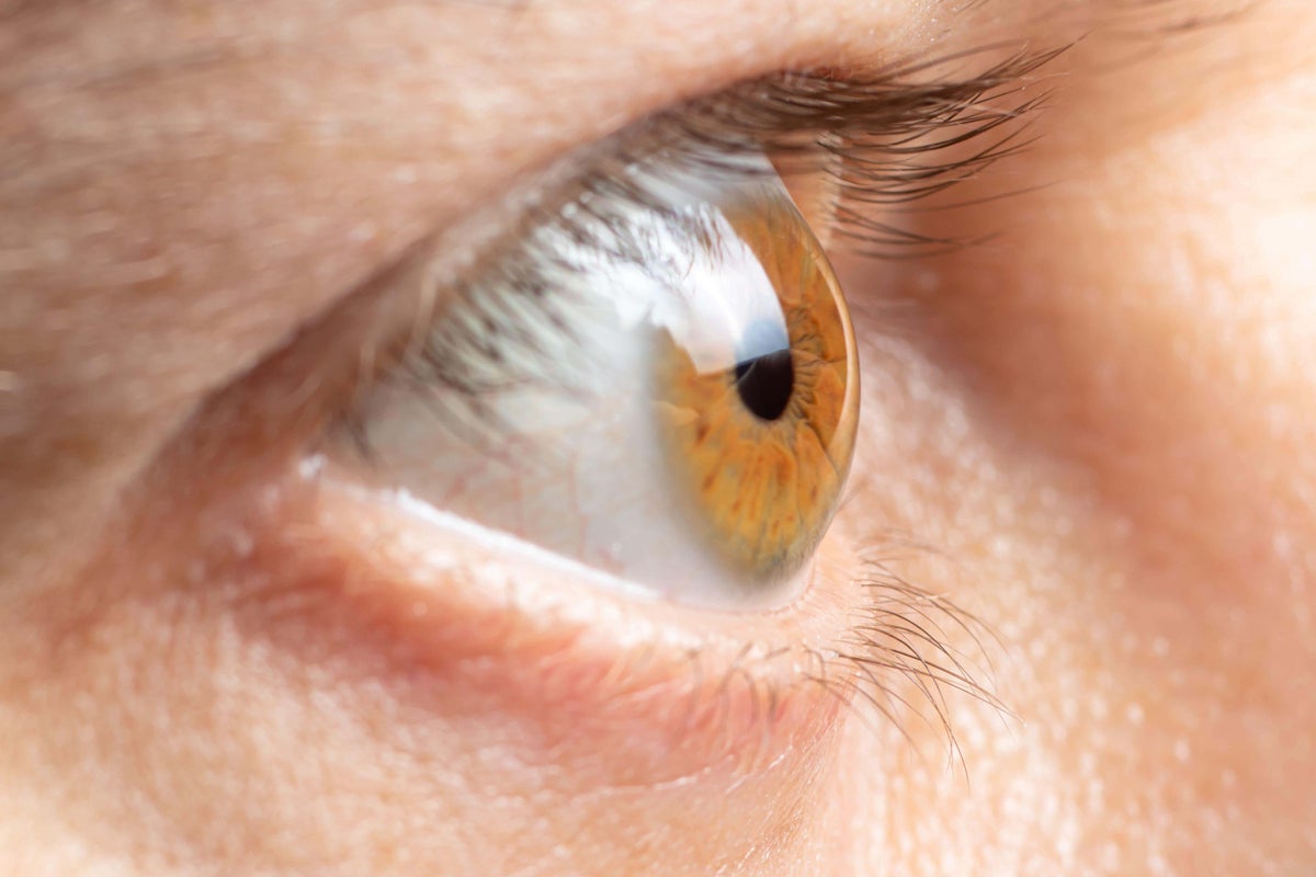 AI could revolutionise glaucoma detection. Here&rsquo;s 6 things everyone should know