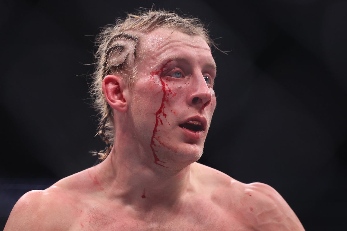 Paddy Pimblett bloodied, bruised and beaten by Justin Gaethje in brutal UFC title fight – UK Times Paddy Pimblett bloodied, bruised and beaten by Justin Gaethje in brutal UFC title fight – UK Times