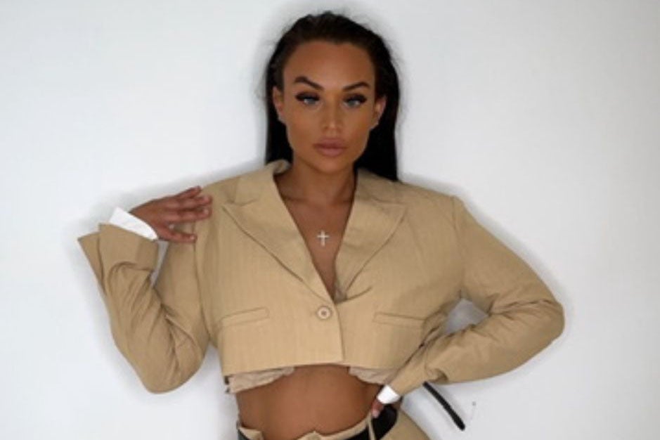 Katy Morgan no longer models like she used to since her surgery