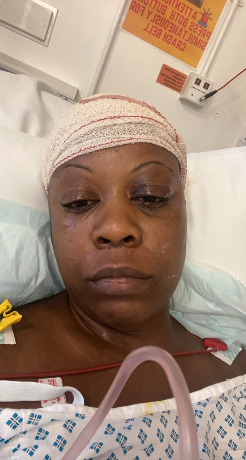 <p>Natasha Carayol had her first stroke in 2022 after experiencing headaches</p>