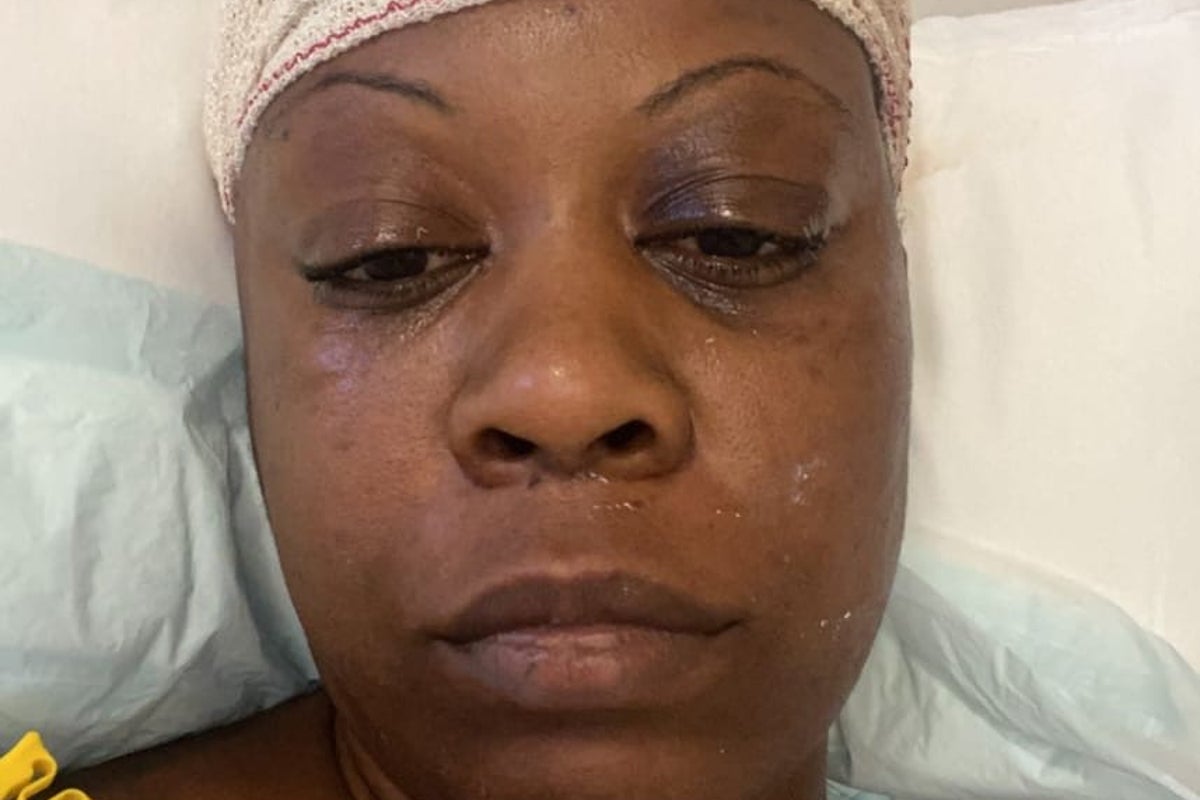 ‘I knew I had high blood pressure – but I never thought it would nearly kill me’ – UK Times ‘I knew I had high blood pressure – but I never thought it would nearly kill me’ – UK Times