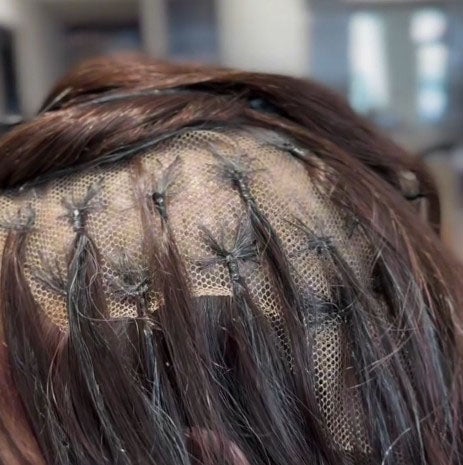 The Kinsey System is designed especially for women with patches of hair loss