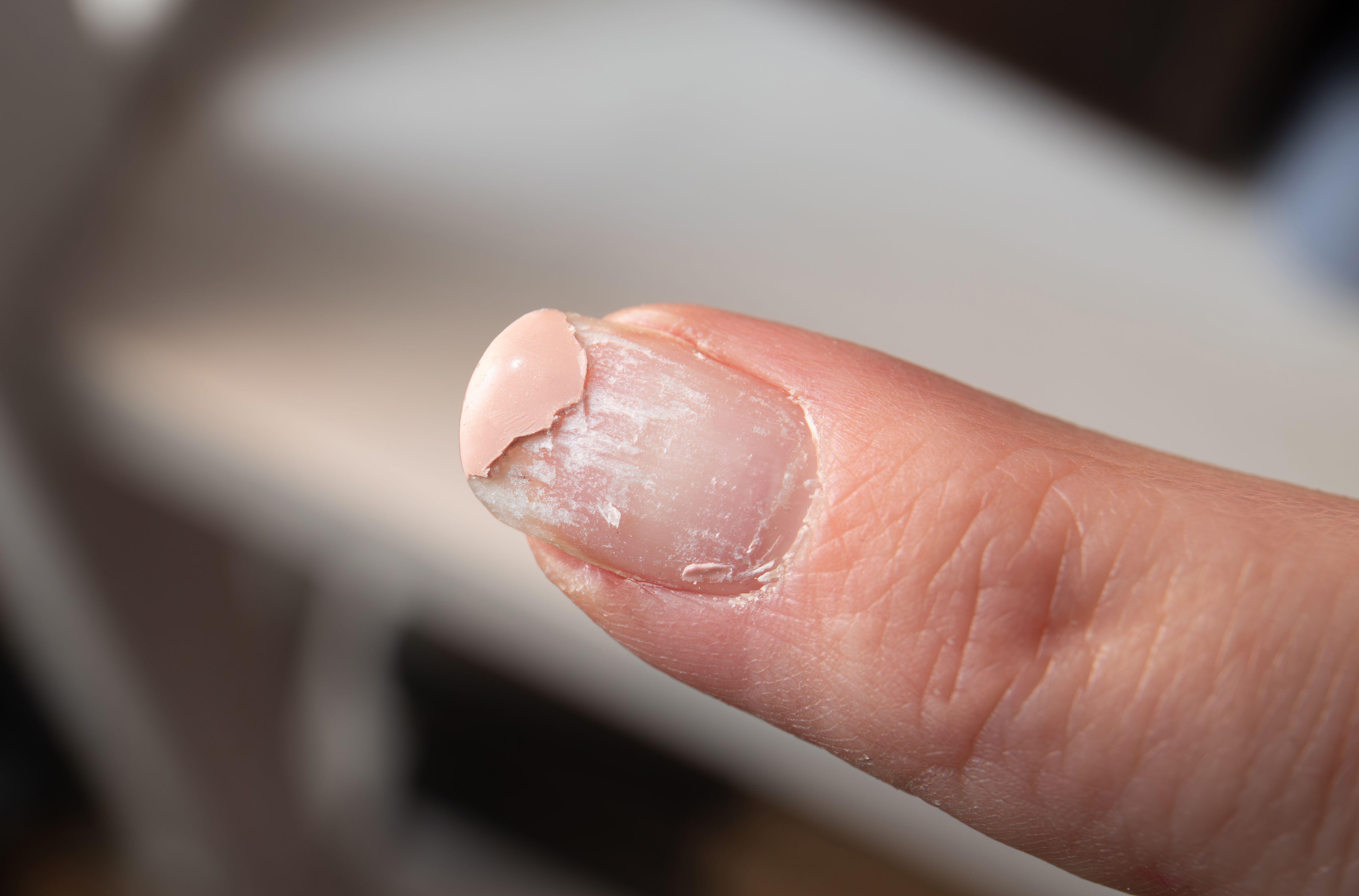 Peeling off a gel manicure is the biggest mistake