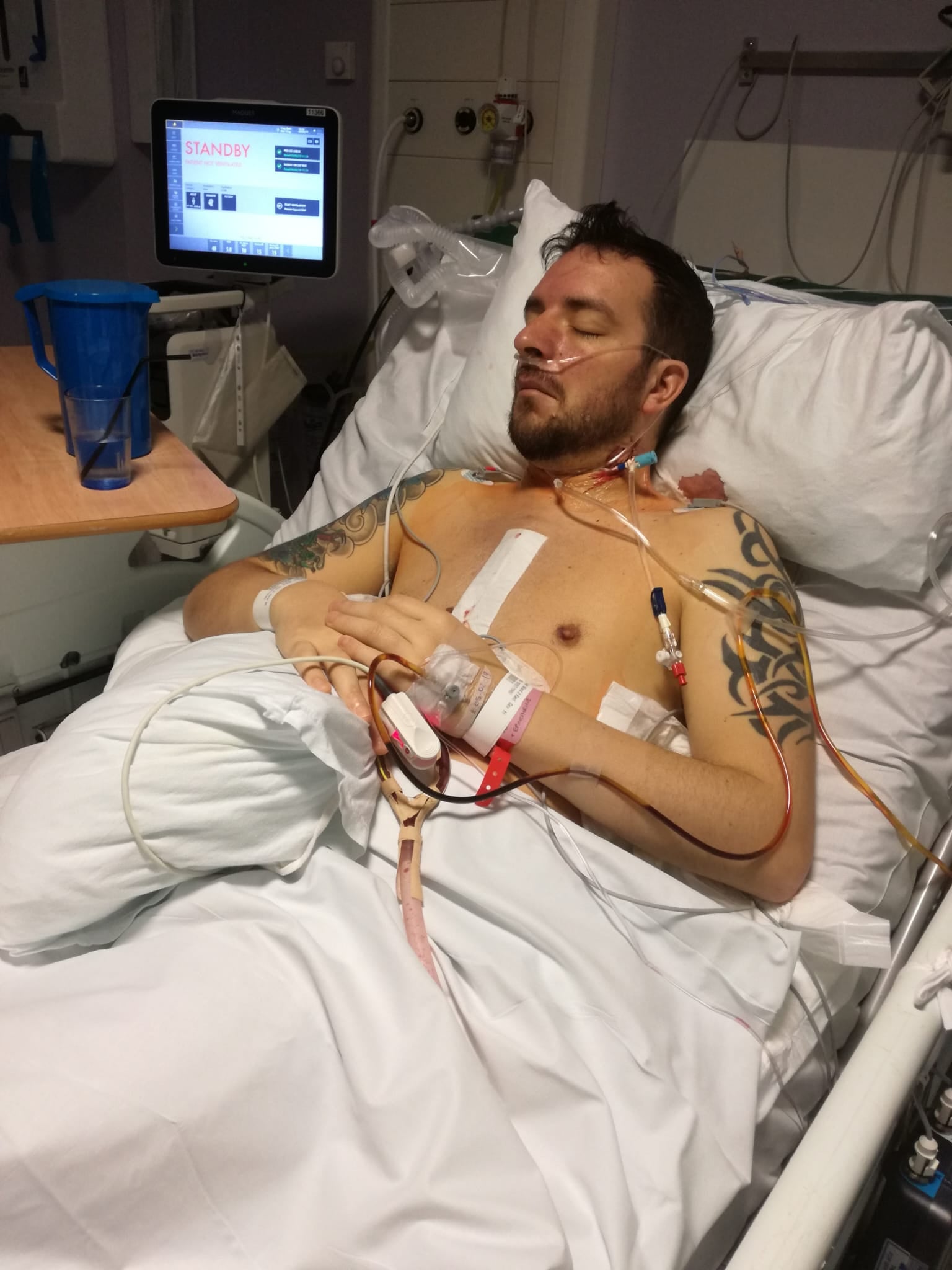 Craig Spiers, 46, said it took five years of GP appointments before he was diagnosed in 2013