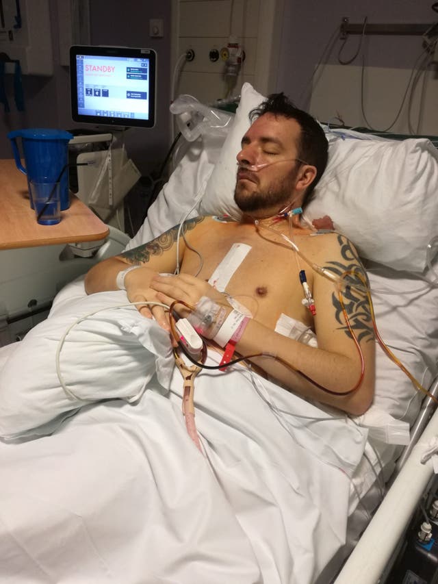 <p>Craig Spiers, 46, said it took five years of GP appointments before he was diagnosed in 2013</p>