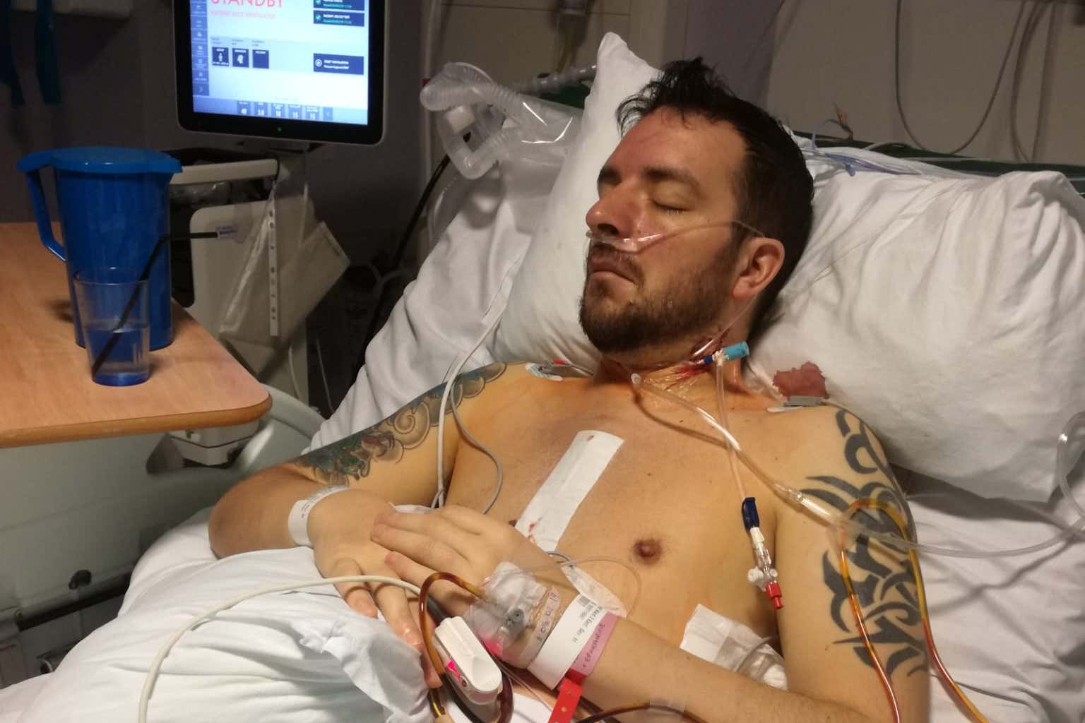 Craig Spiers, 46, from Glasgow, said it took five years of GP appointments before he was diagnosed in 2013