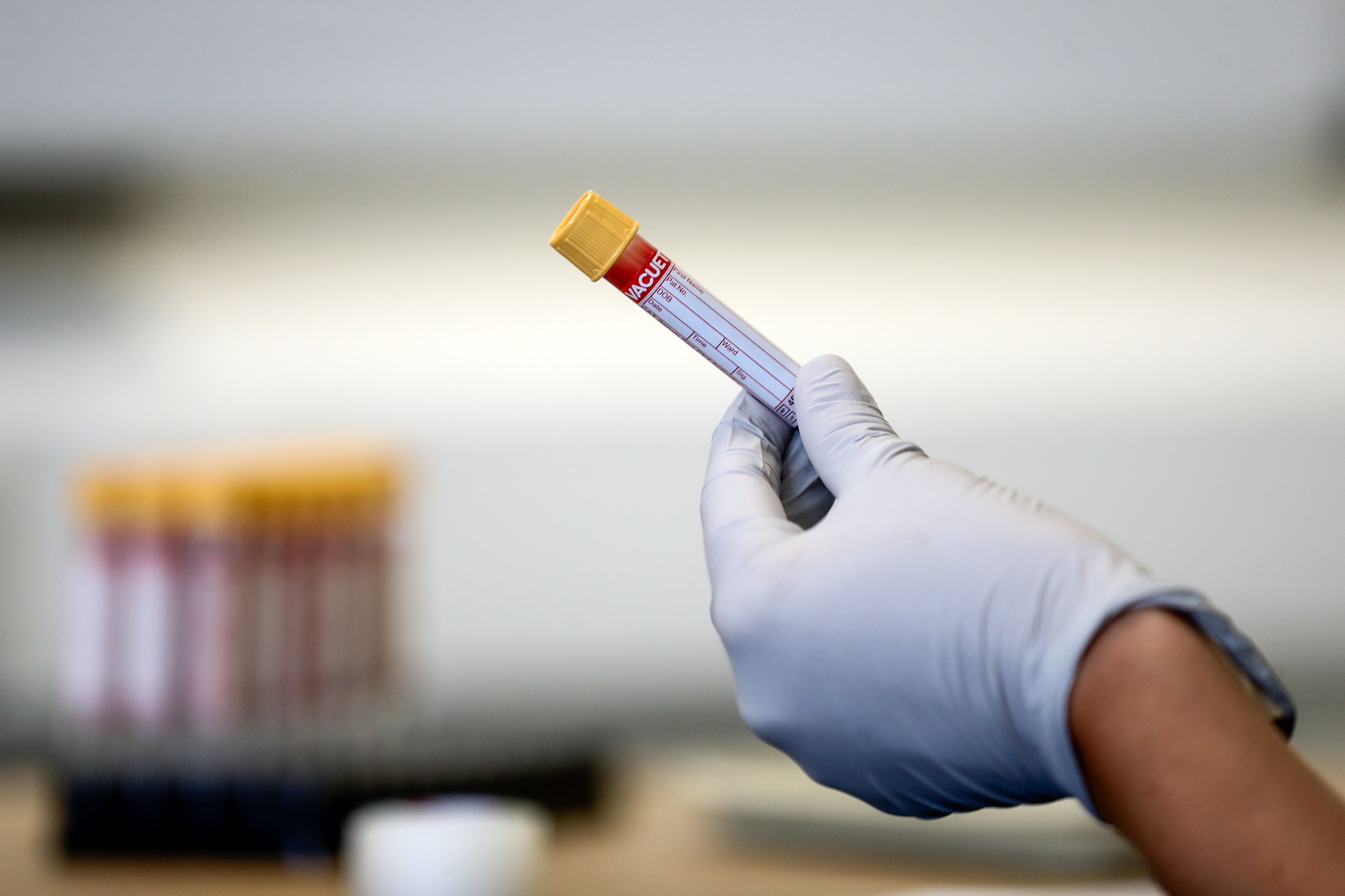 <p>The NHS is already running a major trial looking at whether a multi-cancer early detection blood test works in people with no symptoms</p>