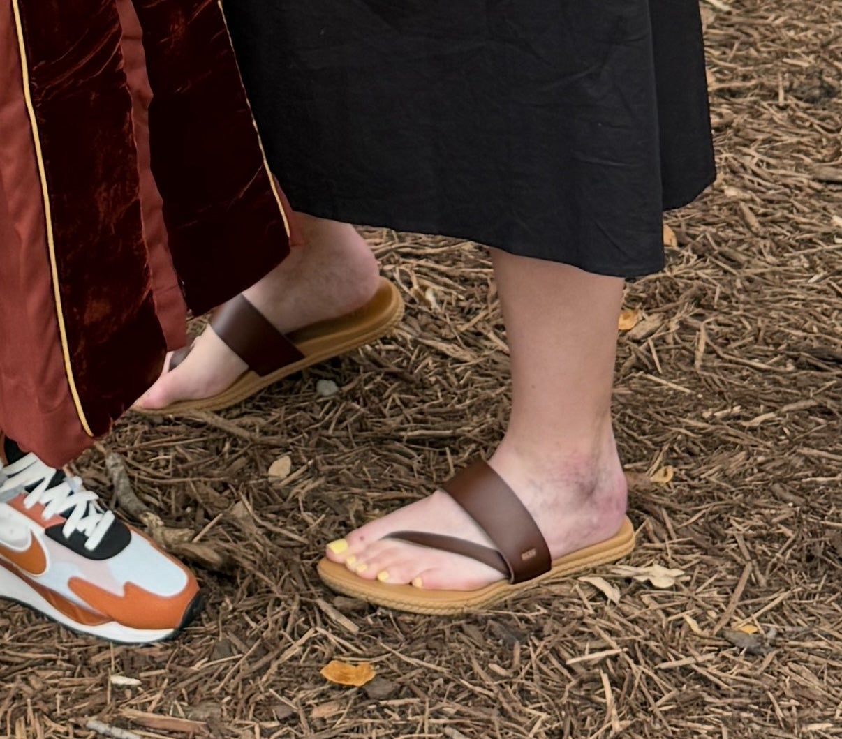Musto's purplish veins are seen on the side of her left ankle and foot. Not everyone with venous insufficiency develops these veins