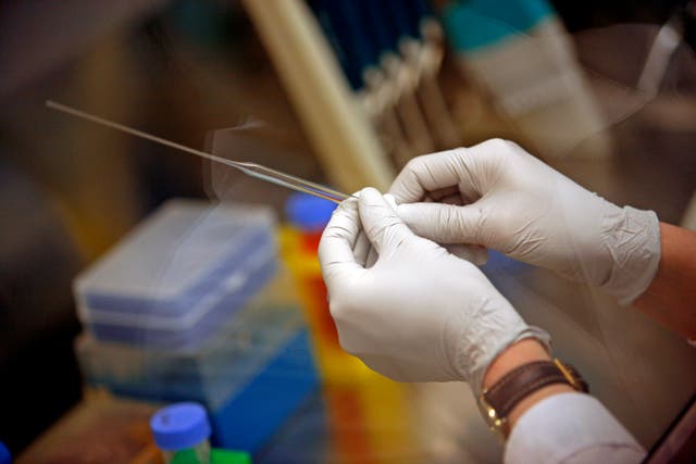 <p>A new kind of stem cell therapy could help ease symptoms of people living with Parkinson’s disease, Southern California researchers say</p>