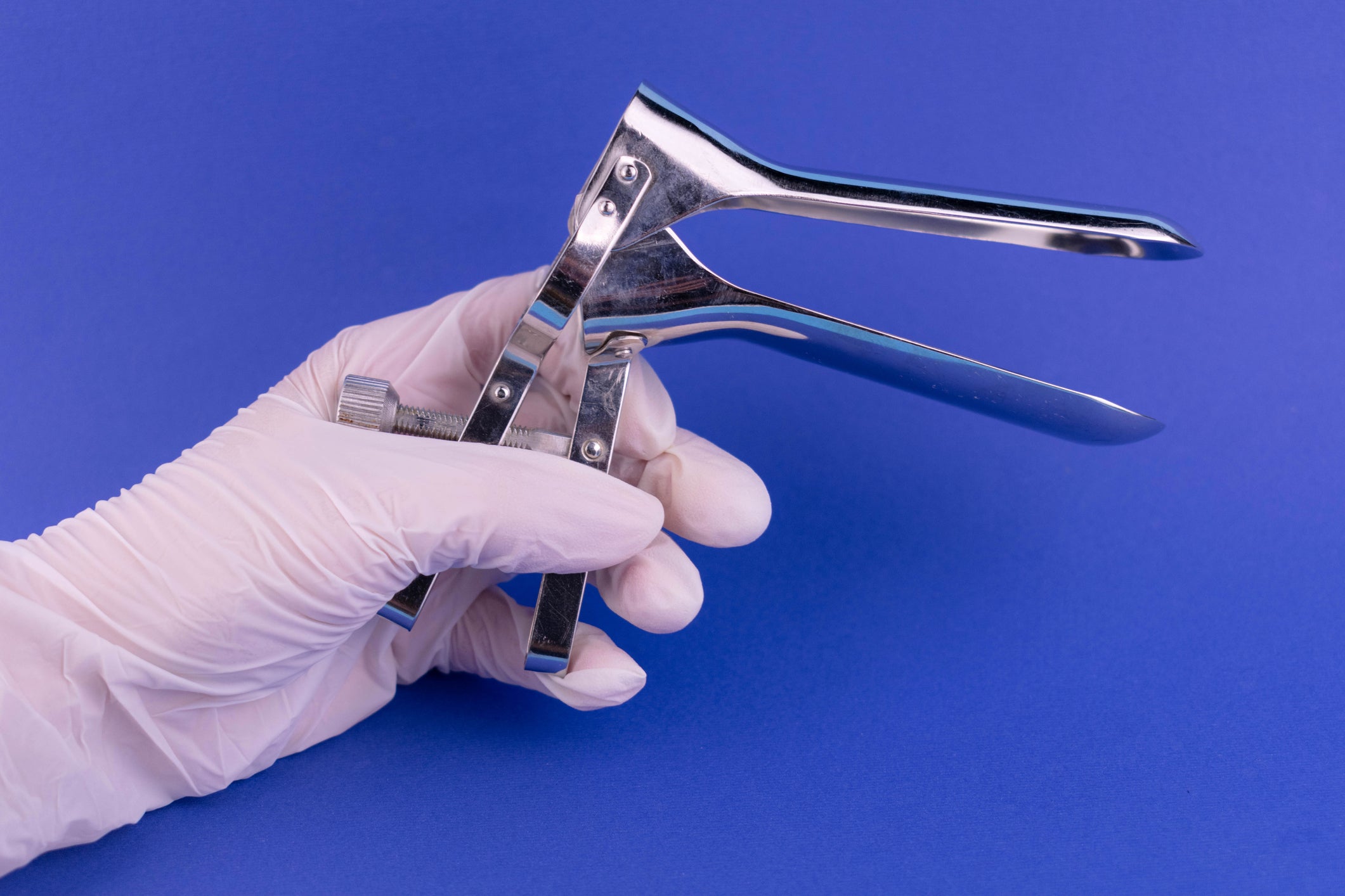 Outdated: A speculum used in smear tests that was first invented in the 1840s