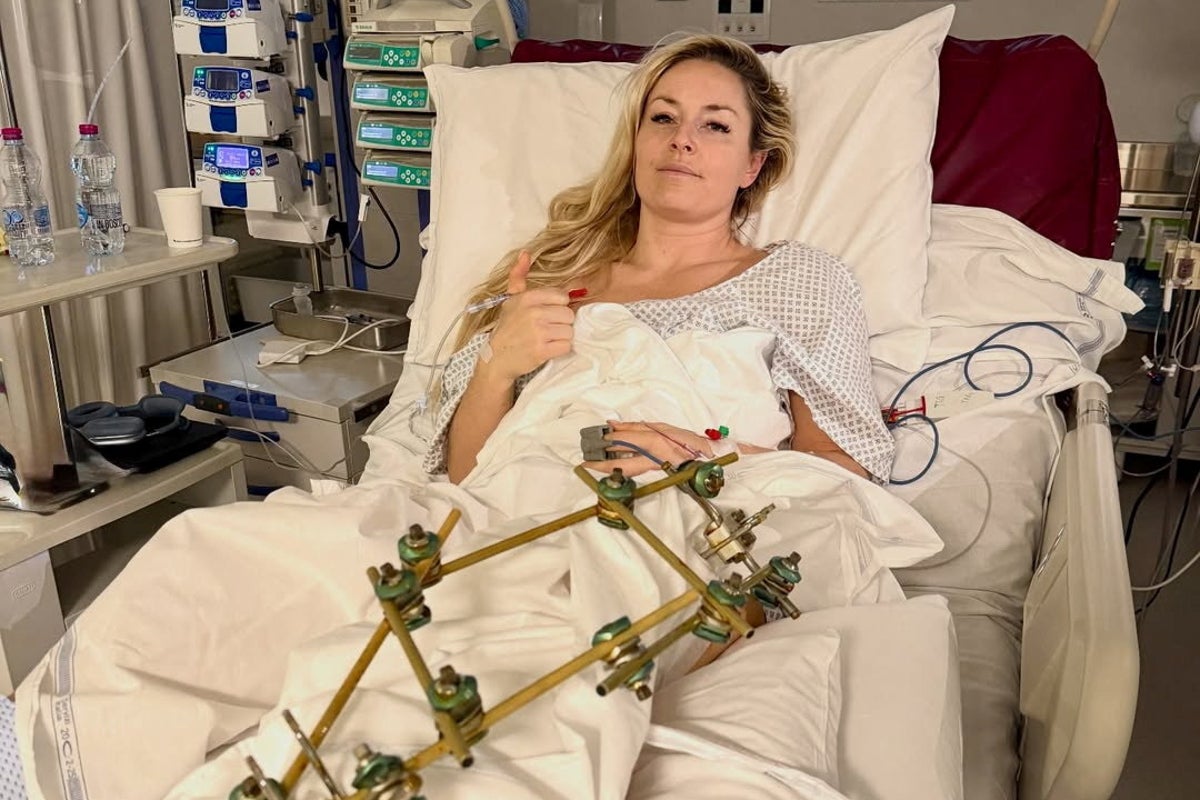 Lindsey Vonn gives health update after third surgery on broken leg Lindsey Vonn gives health update after third surgery on broken leg