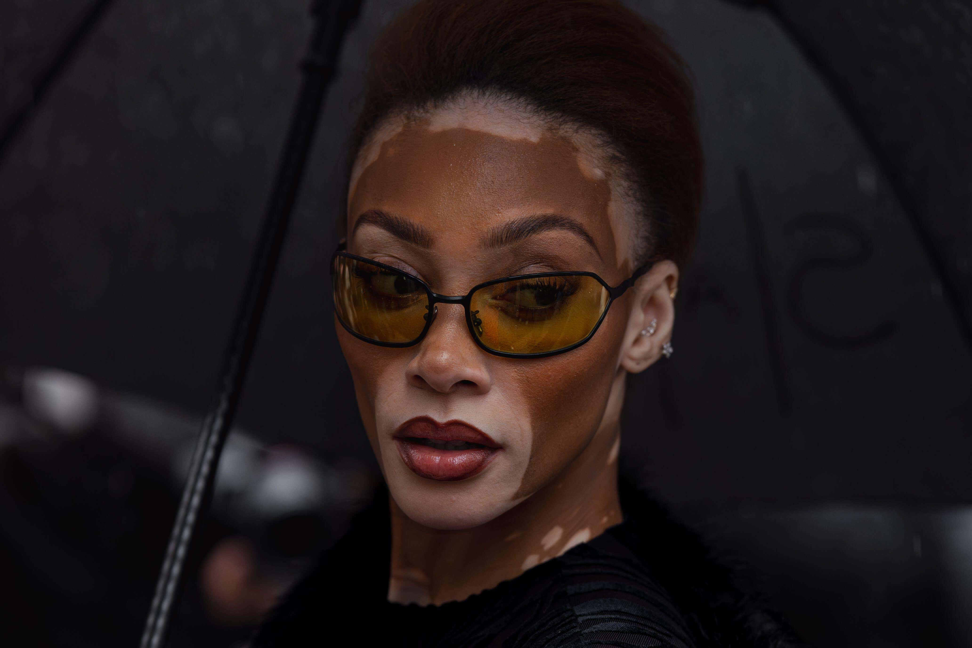 Winnie Harlow sporting the ‘halo lip’ make-up trend (Alamy/PA)