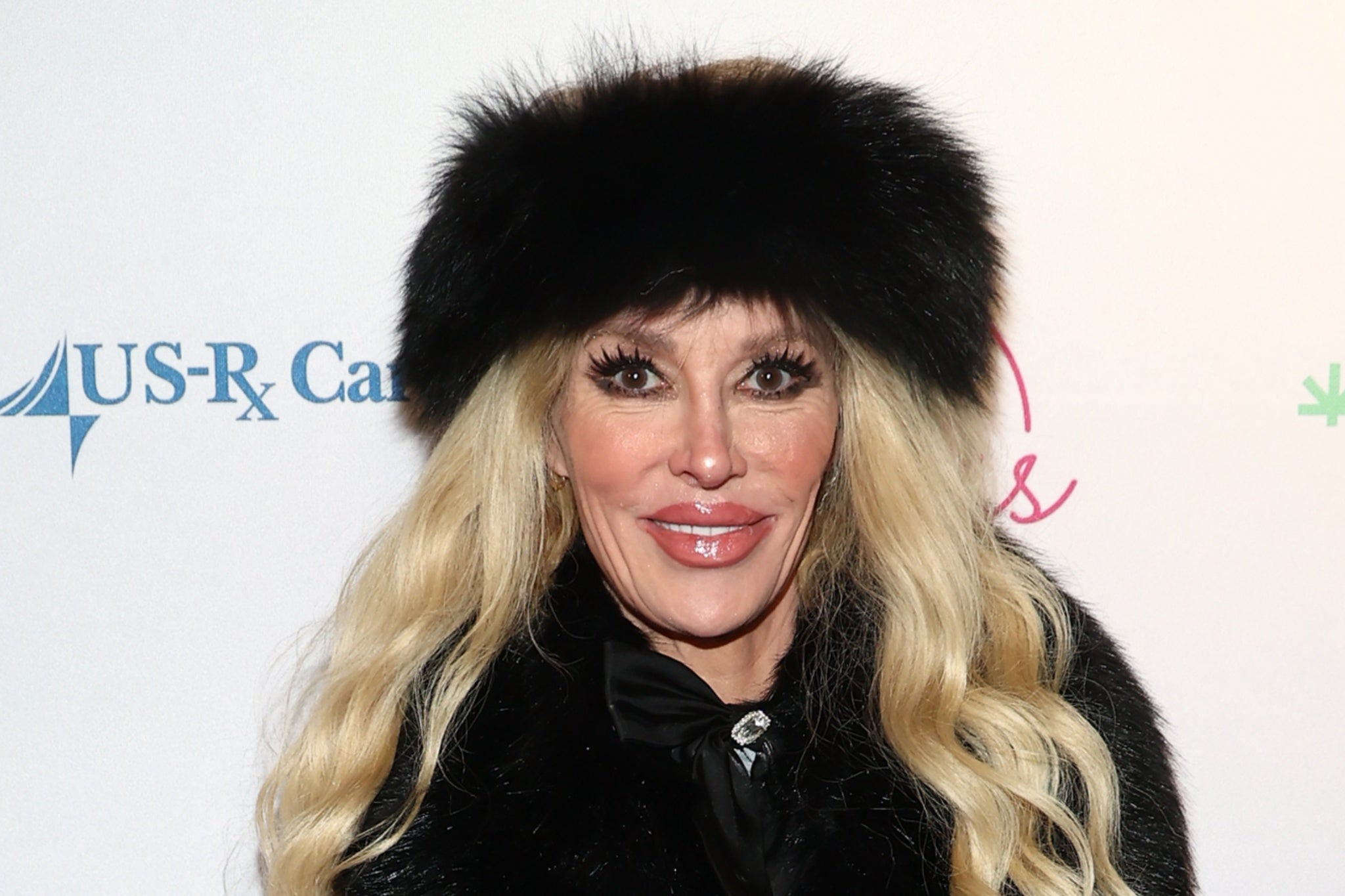 Brandi Glanville says she was ‘shocked’ to learn her ruptured breast implants caused a facial parasite